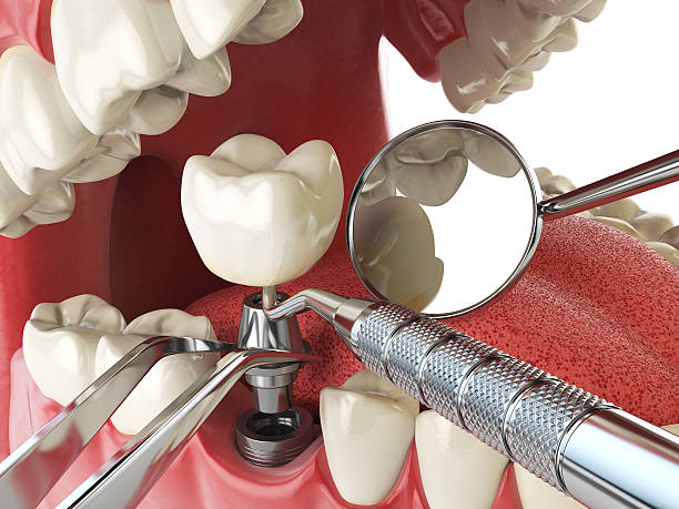 Best Emergency Gum Treatment in Chadbourn, NC